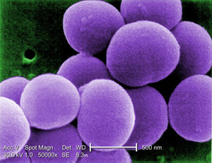 staphylococcus-aureus