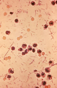 shigella