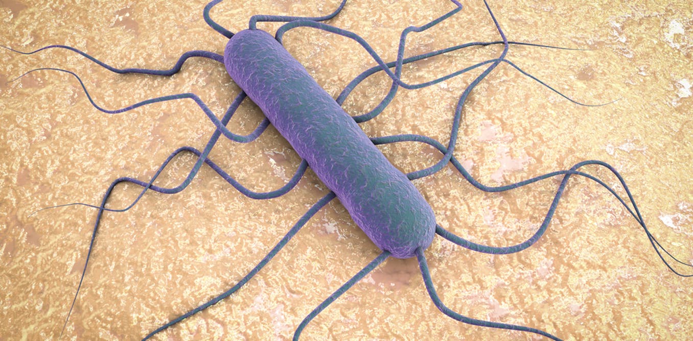 What do you and your family need to know during Listeria Outbreaks Food Poison Journal