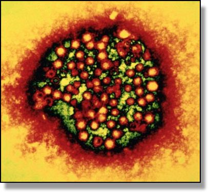 Hepatitis-4