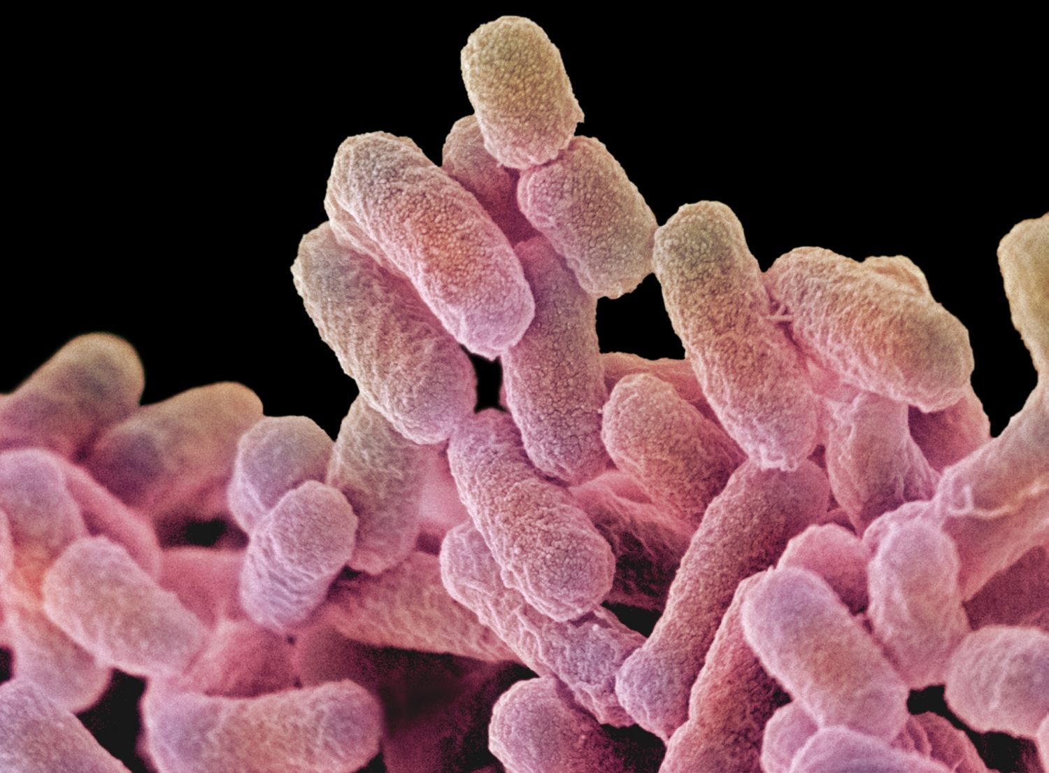 salmonella_bacteria-56a09b265f9b58eba4b2044a