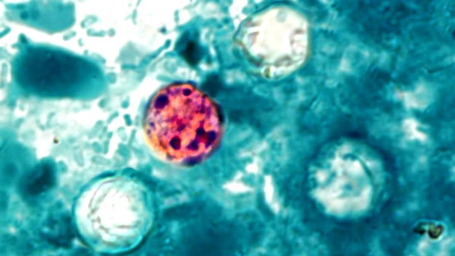 Presence of four cyclospora cayetanensis oocysts in the field of